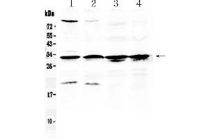 Western blot analysis of RPS6 using anti- RPS6 antibody . (RPS6 antibody  (N-Term))