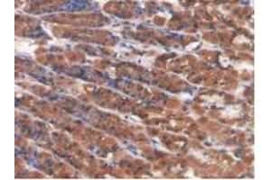 Figure. (CAMK2A antibody  (AA 1-478))