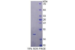 SDS-PAGE analysis of Human CBY1 Protein. (CBY1/PGEA1 Protein)