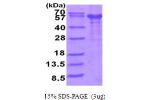 SDS-PAGE (SDS) image for Interleukin 12 Receptor beta 1 (IL12RB1) (AA 1-545) protein (His tag) (ABIN5854052)