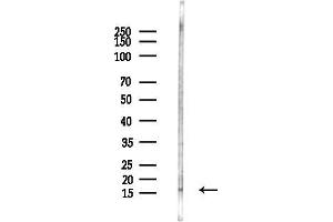 anti-Ribosomal Protein S17 (RPS17) (Internal Region) antibody