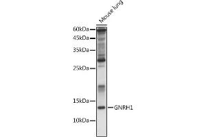 GNRH1 antibody  (AA 24-92)