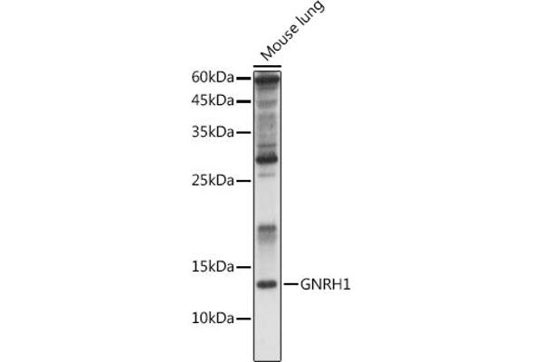 GNRH1 antibody  (AA 24-92)