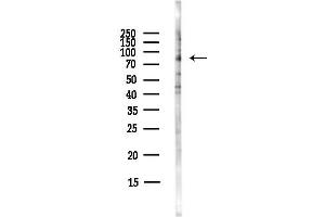 Western blot analysis of lysates from Hela cells(starvation,24h treatment), using HJURP Antibody at 1/1000 dilution.