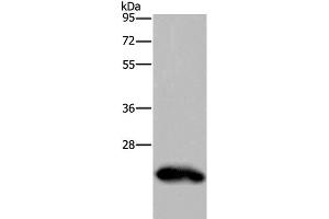 Western Blot analysis of Human placenta tissue using GH2 Polyclonal Antibody at dilution of 1:500 (Growth Hormone 2 antibody)