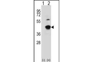 Western blot analysis of GCAT (arrow) using rabbit polyclonal GCAT Antibody (Center) (ABIN391717 and ABIN2841608). (GCAT antibody  (AA 155-181))