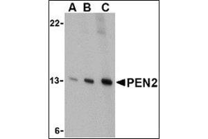 Western blot analysis of PEN2 in K562 cell lysate with this product at (A) 0.