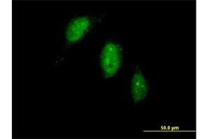 Immunofluorescence of purified MaxPab antibody to TIGD1 on HeLa cell. (TIGD1 antibody  (AA 1-591))