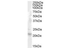 Image no. 1 for anti-Fibroblast Growth Factor 21 (FGF21) (Internal Region) antibody (ABIN374880) (FGF21 antibody  (Internal Region))