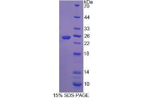 SDS-PAGE analysis of Rat RHAG Protein. (RHAG Protein)