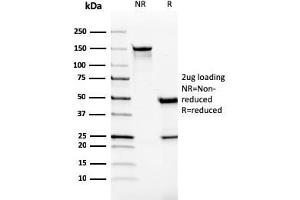 SDS-PAGE Analysis Purified Monospecific Mouse Monoclonal Antibody to VISTA (VISTA/2865). (VISTA antibody)