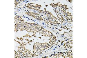 Immunohistochemistry of paraffin-embedded human prostate using RASSF5 antibody. (RASSF5 antibody)