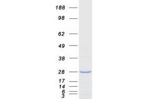 Validation with Western Blot (Frataxin Protein (FXN) (Transcript Variant 1) (Myc-DYKDDDDK Tag))