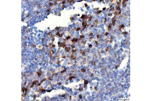 IHC analysis of PDCD1 using anti PDCD1 antibody (ABIN5518784). (PD-1 antibody  (N-Term))