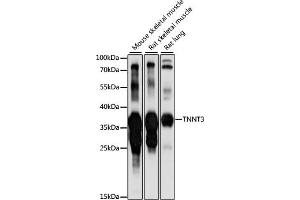 Western blot analysis of extracts of various cell lines, using TNNT3 antibody (ABIN7267145) at 1:1000 dilution. (TNNT3 antibody  (AA 147-256))