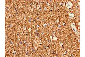 Immunohistochemistry of paraffin-embedded human brain tissue using ABIN7148931 at dilution of 1:100 (CDK5 antibody  (AA 1-292))