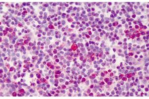Human Tonsil: Formalin-Fixed, Paraffin-Embedded (FFPE) (BCL2L1 antibody  (C-Term))