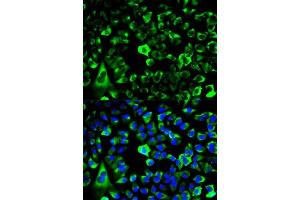 Immunofluorescence analysis of HeLa cells using RPS3 antibody. (RPS3 antibody  (AA 1-243))