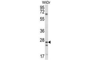 Western blot analysis of SCNN1A Antibody (Center) in WiDr cell line lysates (35ug/lane). (SCNN1A antibody  (Middle Region))