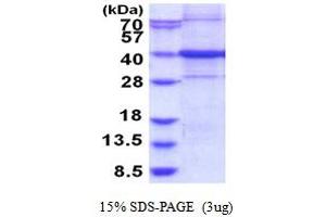 SDS-PAGE (SDS) image for Chromosome 9 Open Reading Frame 100 (C9orf100) (AA 1-335) protein (His tag) (ABIN5853920) (C9orf100 Protein (AA 1-335) (His tag))