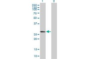 Western Blot analysis of MRAP2 expression in transfected 293T cell line by MRAP2 MaxPab polyclonal antibody.