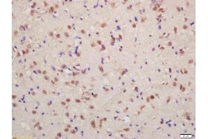 Formalin-fixed and paraffin embedded rat brain labeled with Anti-phospho-FMRP (Ser500) Polyclonal Antibody, Unconjugated (ABIN1714273) at 1:200 followed by conjugation to the secondary antibody and DAB staining (FMR1 antibody  (pSer500))