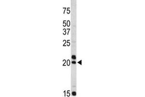 Western blot analysis of VIP antibody and Jurkat lysate. (Vip antibody  (AA 139-167))