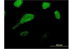 Immunofluorescence of monoclonal antibody to GLE1 on HeLa cell. (GLE1 antibody  (AA 140-240))