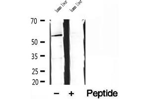 Western blot analysis of extracts of human liver tissue, using SKAP2 antibody. (SKAP2 antibody  (C-Term))