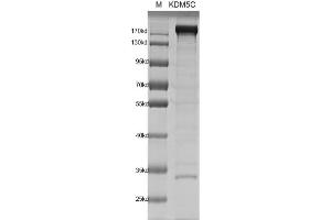 Recombinant JARID1C / KDM5C protein gel.