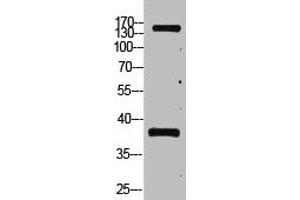 Western blot analysis of Hela, diluted at 1:2000. (CD45 antibody)