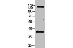 Western Blotting (WB) image for anti-Protein tyrosine Phosphatase, Receptor Type, C (PTPRC) antibody (ABIN7189328)