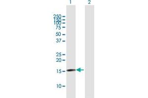 Western Blot analysis of TSEN15 expression in transfected 293T cell line by TSEN15 MaxPab polyclonal antibody. (TSEN15 antibody  (AA 1-171))