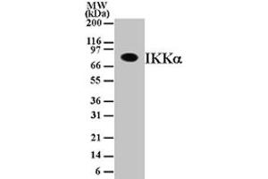 Image no. 1 for anti-conserved Helix-Loop-Helix Ubiquitous Kinase (CHUK) antibody (ABIN208066) (IKK alpha antibody)