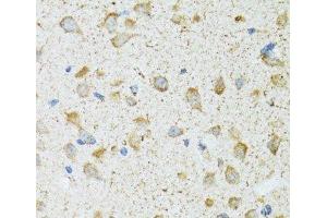 Immunohistochemistry of paraffin-embedded Rat brain using COG2 Polyclonal Antibody at dilution of 1:100 (40x lens). (COG2 antibody)