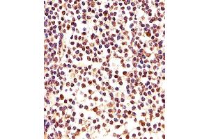 Immunohistochemical analysis of paraffin-embedded H. (PCNA antibody  (C-Term))