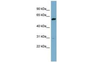 Image no. 1 for anti-24-Dehydrocholesterol Reductase (DHCR24) (AA 431-480) antibody (ABIN6741964) (Seladin 1 antibody  (AA 431-480))