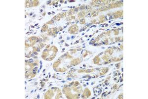 Immunohistochemistry of paraffin-embedded human stomach using EIF1AX antibody at dilution of 1:100 (40x lens). (EIF1AX antibody)