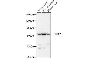 Western blot analysis of extracts of various cell lines, using EPHX2 antibody (ABIN7266999) at 1:500 dilution. (EPHX2 antibody)