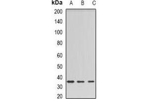 Western blot analysis of Barttin expression in HEK293T (A), rat liver (B), rat kidney (C) whole cell lysates.
