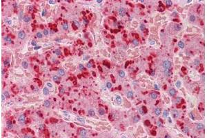 Human Liver: Formalin-Fixed, Paraffin-Embedded (FFPE) (APOA2 antibody  (AA 1-100))