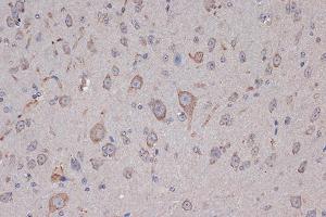 Immunohistochemistry of paraffin-embedded mouse brain using Xanthine Oxidase (XDH) (XDH) Rabbit mAb (ABIN7271408) at dilution of 1:100 (40x lens).