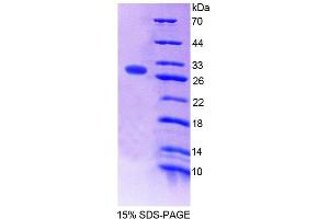 SDS-PAGE (SDS) image for Folylpolyglutamate Synthase (FPGS) (AA 210-439) protein (His tag) (ABIN4989288)