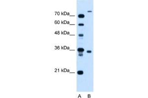 Western Blotting (WB) image for anti-FLJ22167 antibody (ABIN2464002) (FLJ22167 antibody)