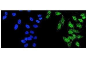 anti-Histone Deacetylase 5 (HDAC5) (AA 13-1107) antibody