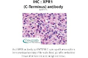 Image no. 1 for anti-Xenotropic and Polytropic Retrovirus Receptor 1 (xpr1) (C-Term) antibody (ABIN1740877)