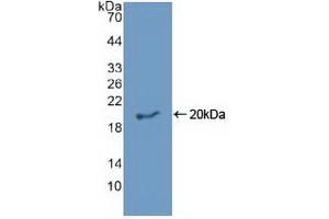 Detection of Recombinant EREG, Human using Polyclonal Antibody to Epiregulin (EREG) (Epiregulin antibody)