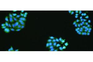 The image is immunofluorescence of HepG2 cell using VMA21 Polyclonal Antibody at dilution of 1:50. (VMA21 antibody)