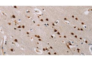 Immunohistochemistry of paraffin-embedded Human brain tissue using TONSL Polyclonal Antibody at dilution 1:60 (NFKBIL2 antibody)