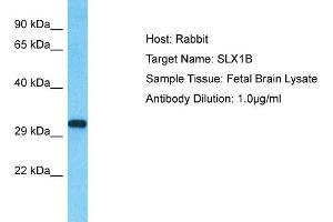 Host: Rabbit Target Name: SLX1B Sample Type: Fetal Brain lysates Antibody Dilution: 1. (SLX1A/GIYD2 antibody  (N-Term))